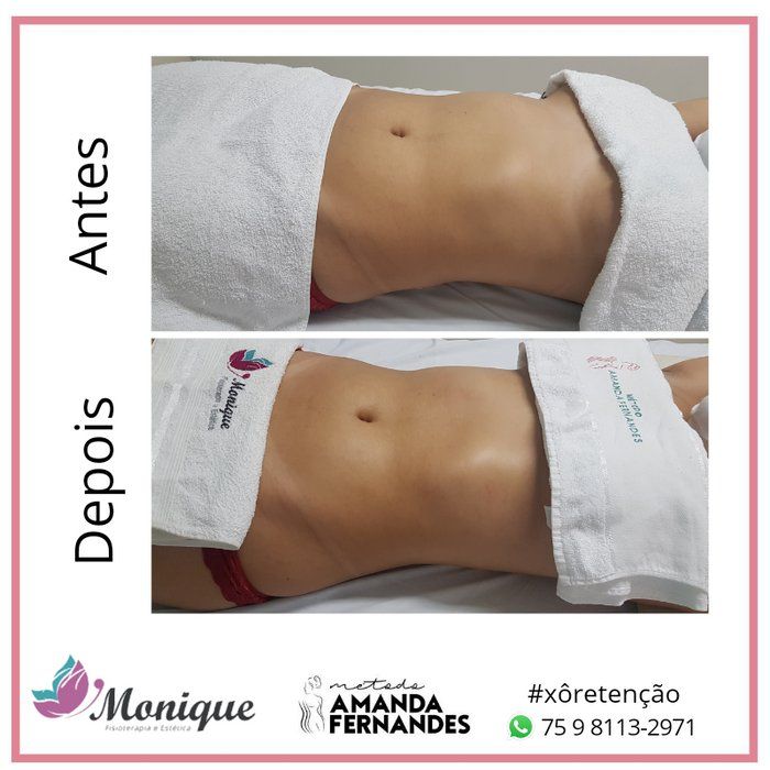 Monique Mota - Saúde e Estética Integrativa - Método Amanda Fernandes (MAF)
