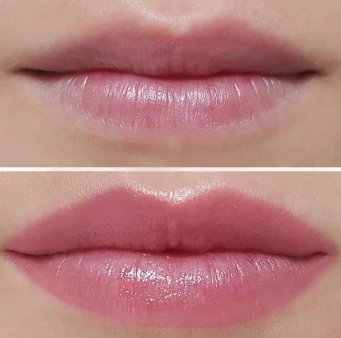 Silvana Baltazar Centro de Estética - beleza & estética, & bem-Estar - Micropigmentação de Labios