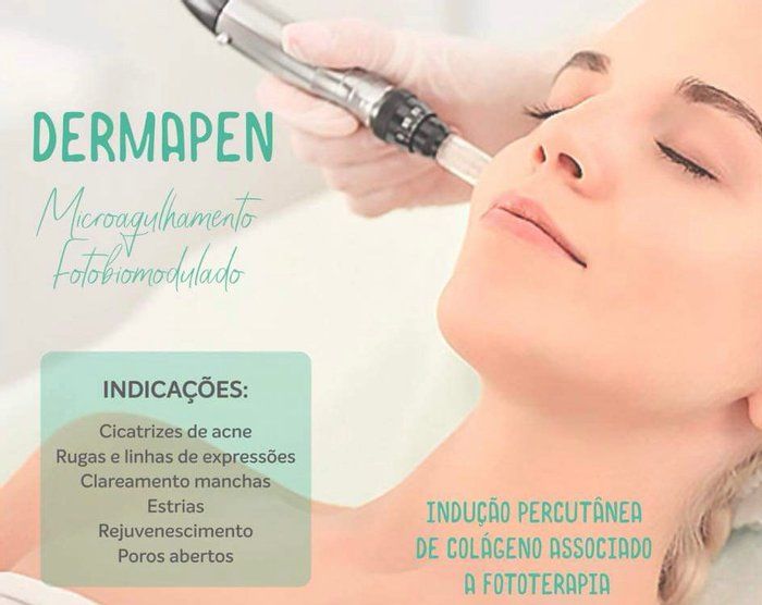 Silvana Baltazar Centro de Estética  - beleza & estética, & bem-Estar - Microagulhamento facial