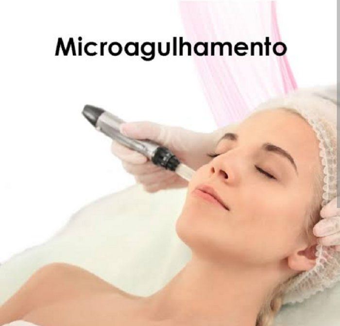 Bonita Derme  - Estética Avançada  - Microagulhamento facial e corporal 