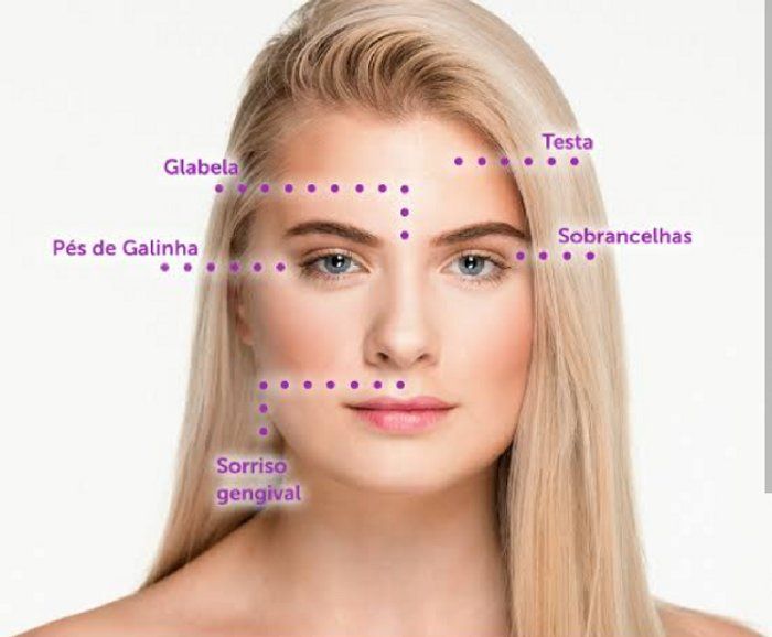 Bonita Derme  - Estética Avançada  - Botox 1 Região 