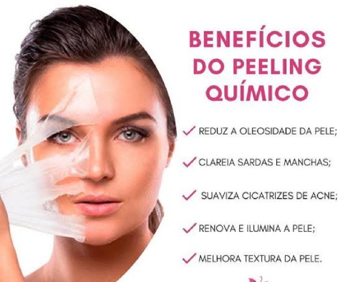 Bonita Derme - Estética Avançada - Peelins