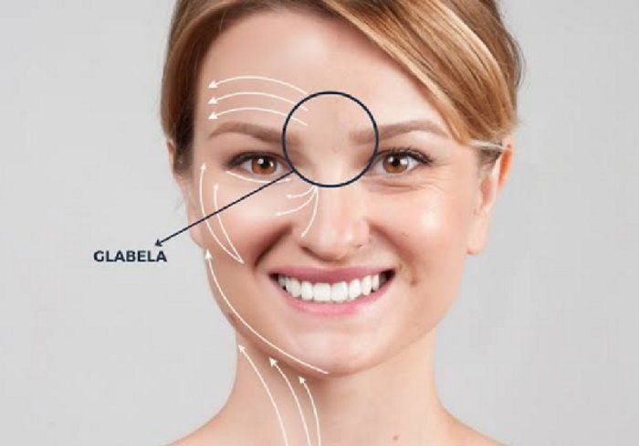 Bonita Derme - Estética Avançada - Fios para Glabela