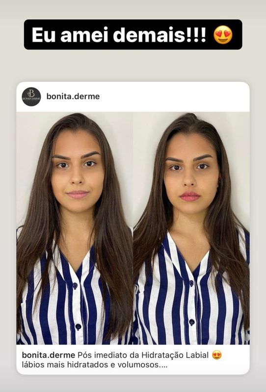 Bonita Derme - Estética Avançada - Hidratação Labial