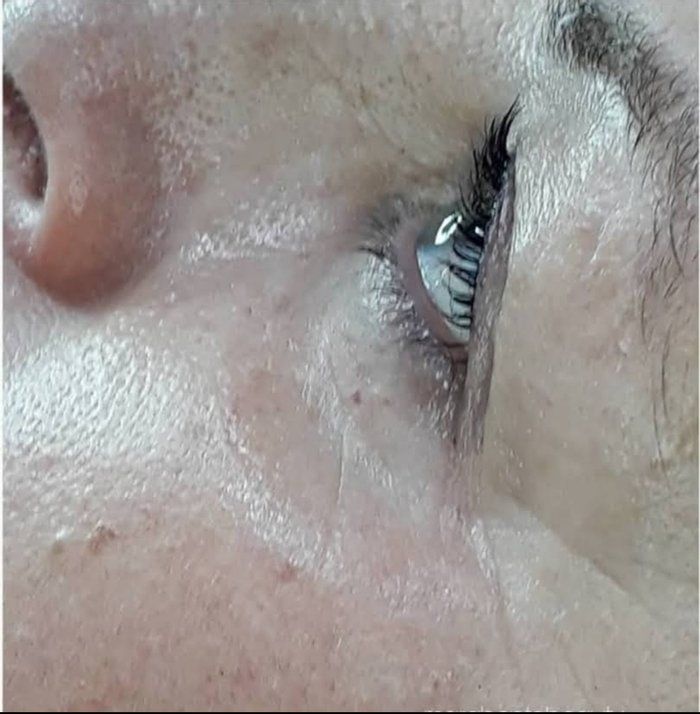 Mara Bento Beauty - Cílios e Sobrancelhas - Lash Botox (Opcional tintura)