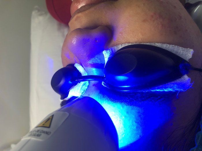 Bela Rosa Centro de Estética - beleza & estética - Limpeza de pele deep