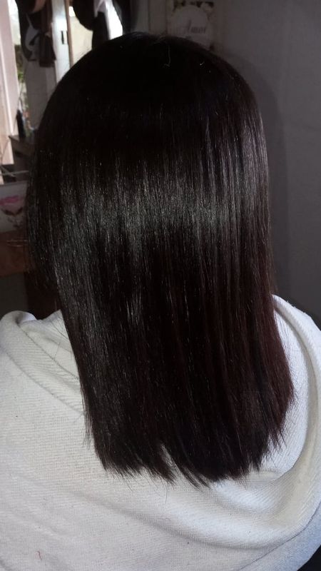 Suéllen Couto - Hair - Botox