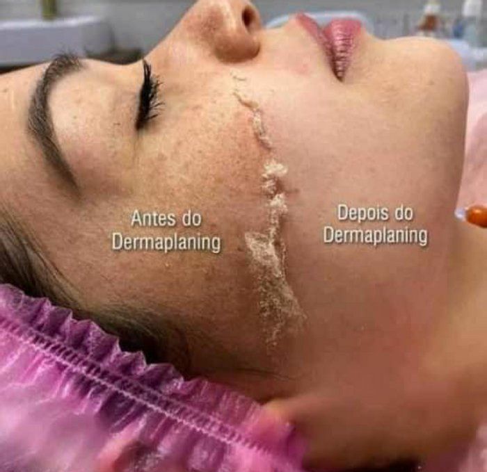 Nilvania Silva - Estética - Saúde - Beleza - dermablanding