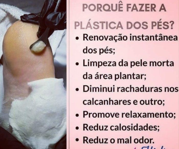 Rainha das unhas design artesanal  - beleza & estética - plástica nos pés 