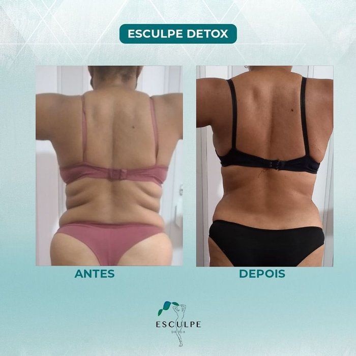 Estética Lucília Corsini - beleza & estética - Esculpe Detox