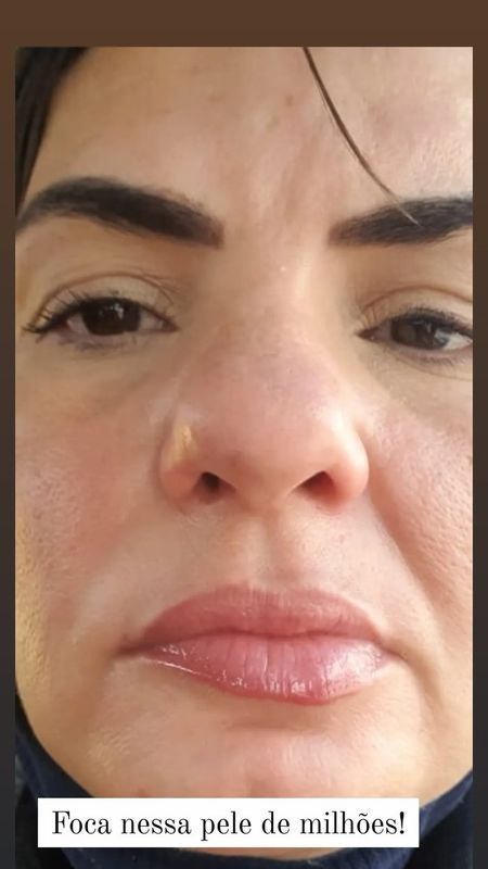 Janaina Patrício - beleza & estética - skinbooster