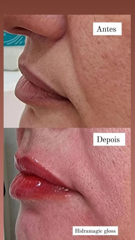 Janaina Patrício - beleza & estética - Hydragloss