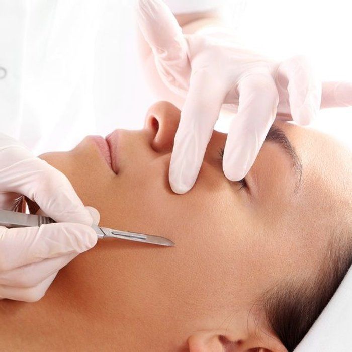 Janaína Rotelli Biomédica Esteta - beleza & estética - Dermaplaning associado a limpeza de pele