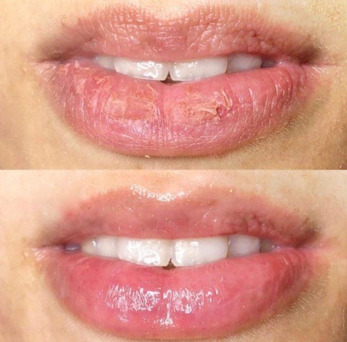 Janaína Rotelli Biomédica Esteta - beleza & estética - Hydragloss