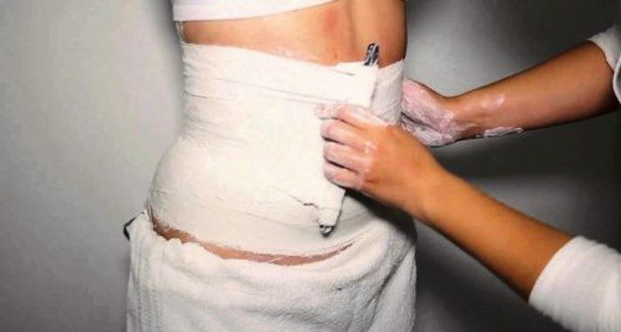 Janaína Rotelli Biomédica Esteta - beleza & estética - Lipo gessada