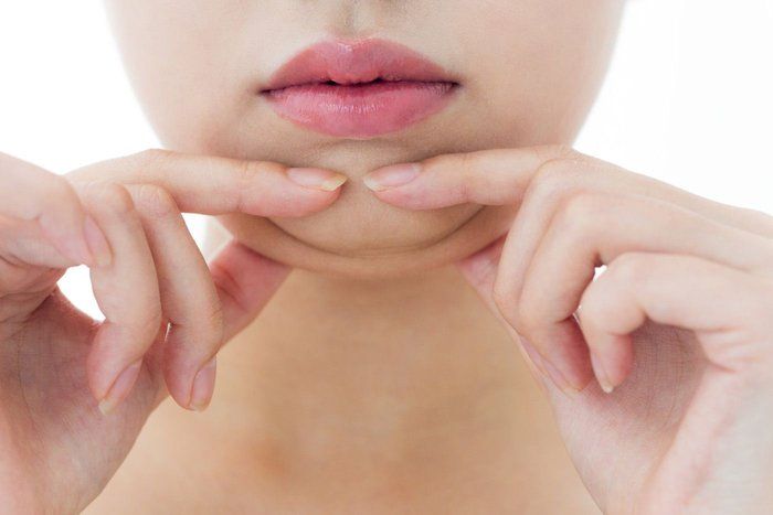 Janaína Rotelli Biomédica Esteta - beleza & estética - Lipo de Papada