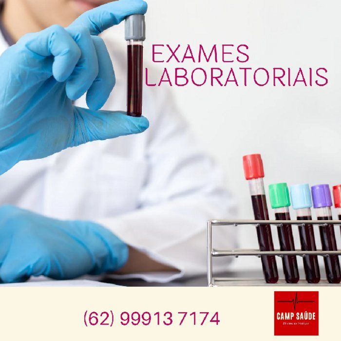 CAMP Gestão em Saúde - Central de Agendamentos de Exames - Administracão em saúde - Hemograma completo