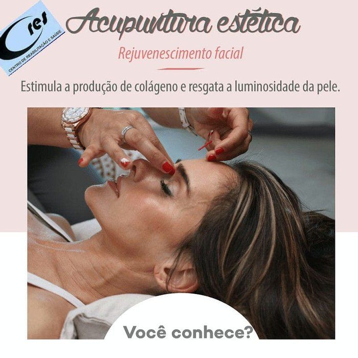 CRES-Centro de Reabilitação e Saúde - saúde & bem-estar - Acupuntura em Estetica Facial