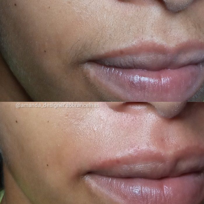 Sobrancelhas Amanda Oliveira - beleza/estética - Epilação do buço