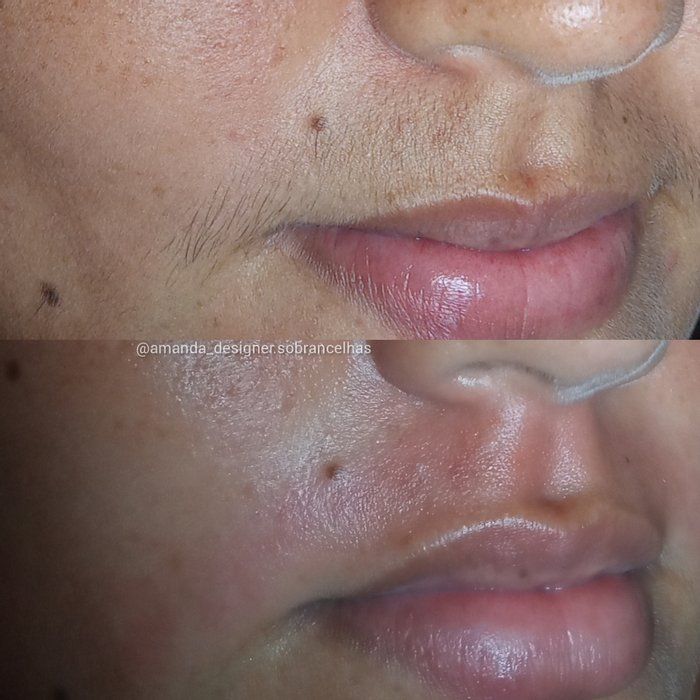 Sobrancelhas Amanda Oliveira - beleza/estética - Epilação do buço