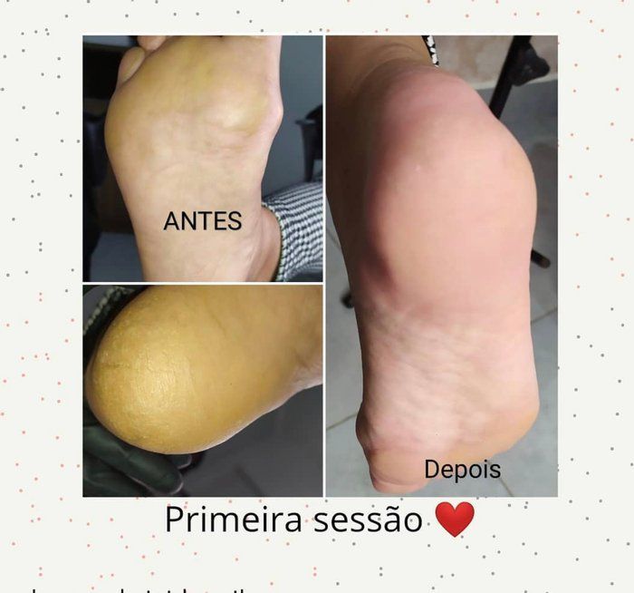 Equipe Fukuda Hair  - beleza & estética - Plástica dos pés 