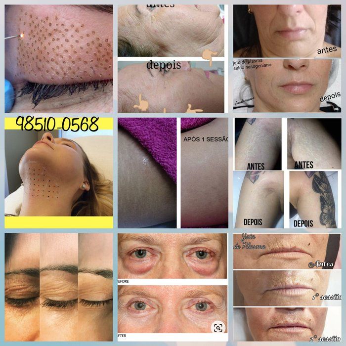Espaço Una - beleza & estética - Estetica Facial e Corporal