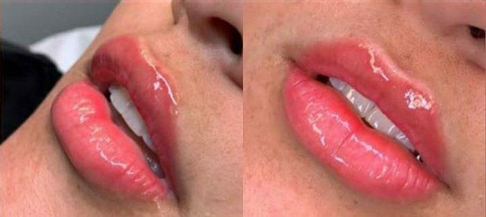 Studio de Beleza Thaís Santos - beleza & estética - Hidra Lips Labial 