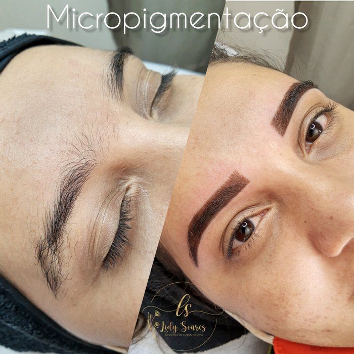 Lidy Sobrancelhas - beleza & estética - MICROPIGMENTAÇÃO