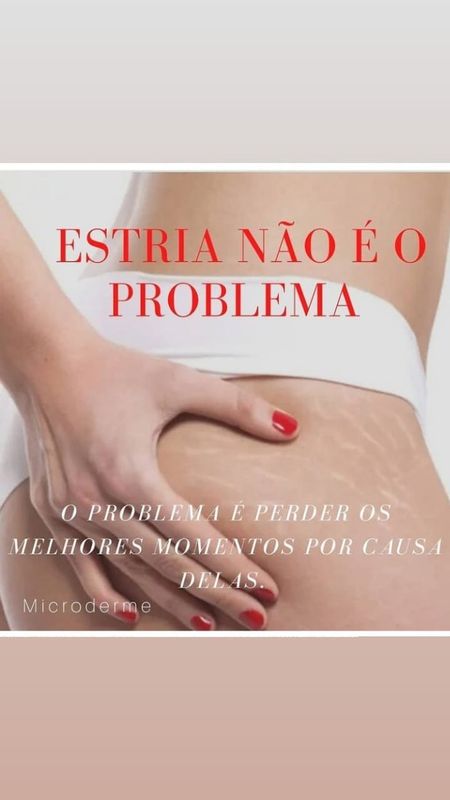 estéticaemce - beleza & estética - microderme tratamento de ESTRIAS