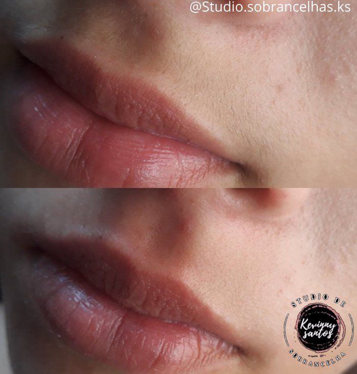 Studio Kevinny Santtos - beleza & estética - Depilação de Burço