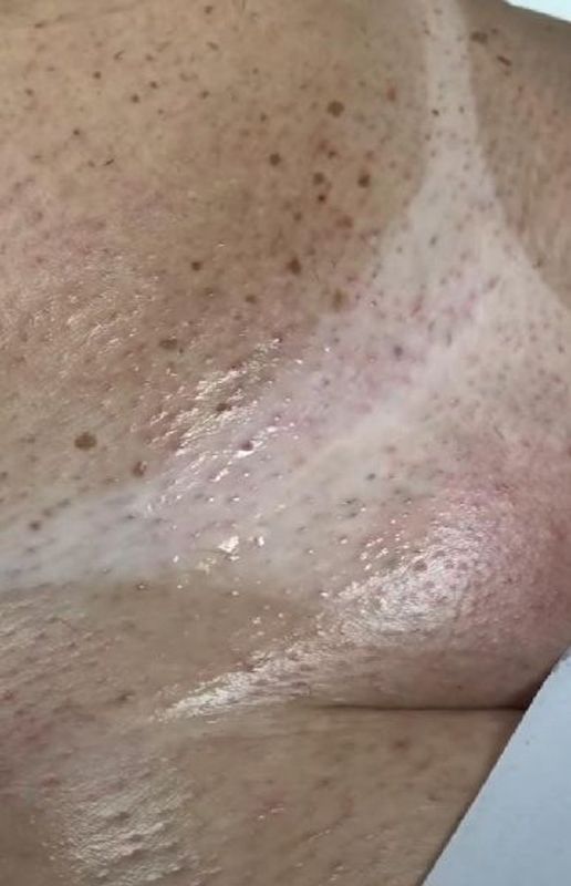 Sheila Blue - beleza & estética - Depilação com cera quente Intima completa feminina