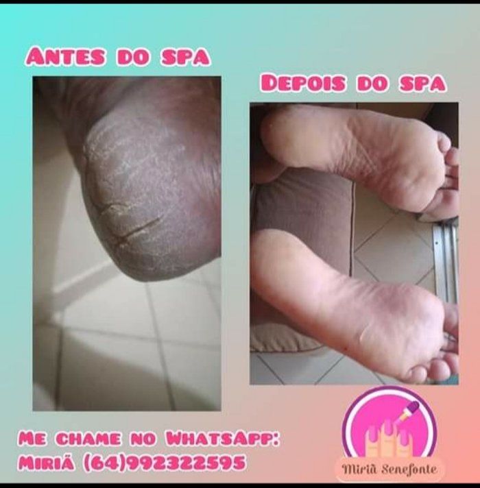 Miriã Senefonte - saúde & bem-estar - SPA dos Pés 