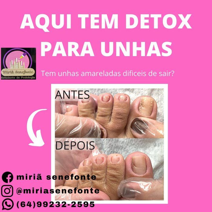 Miriã Senefonte - saúde & bem-estar - Detox das Unhas