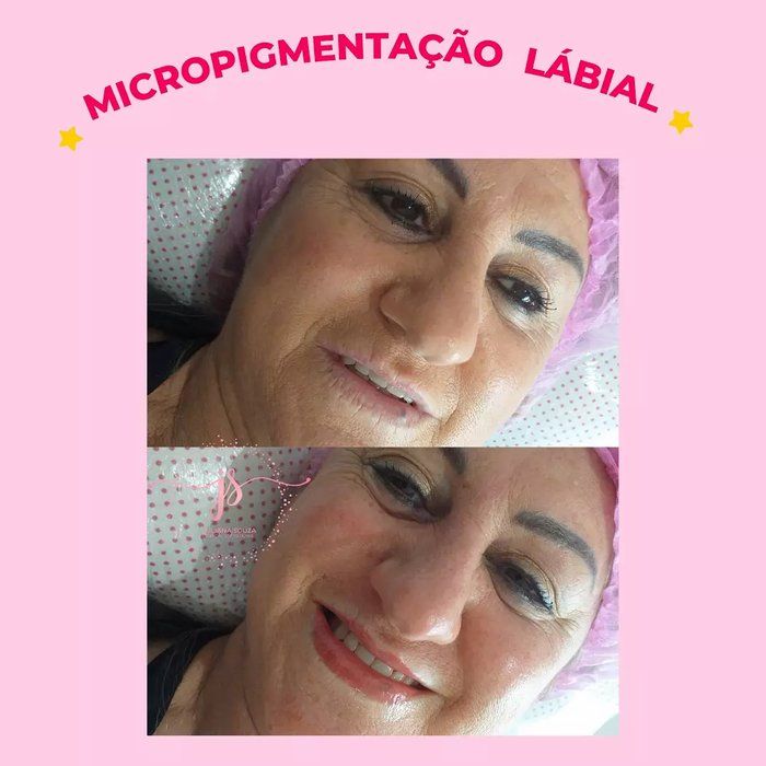 Juliana Souza - Estética e Saúde - Micropigmentação lábial