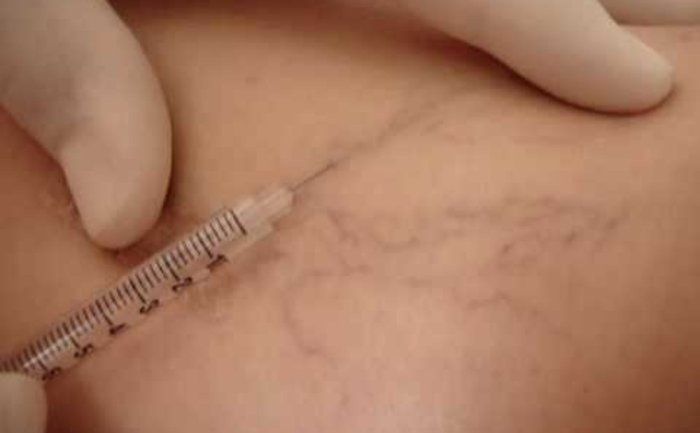 CLINICA DA BELEZA - Micropgmentacao & Estetica Avancada - VARIZES