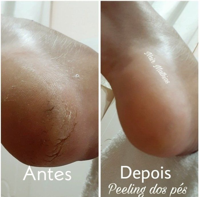 NairMathiasNails - beleza - Pacote IV