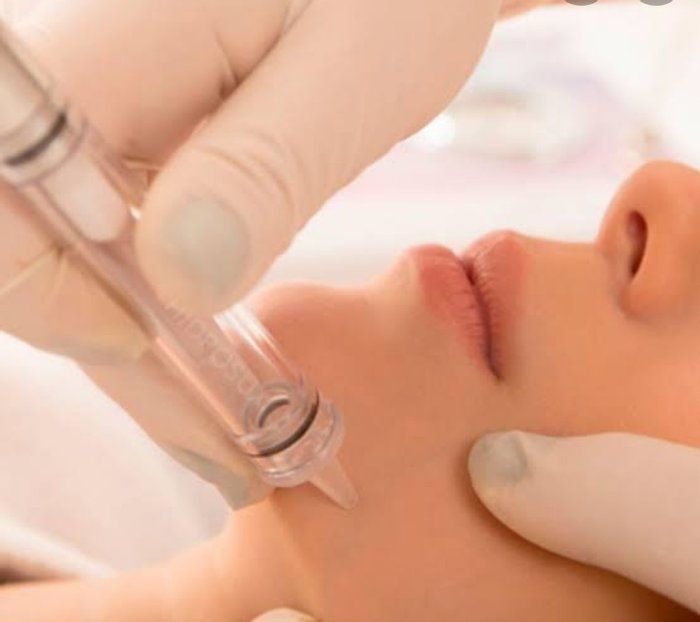 Studio Éryka Colvello - beleza & estética - Limpeza de Pele com Peeling de Diamante