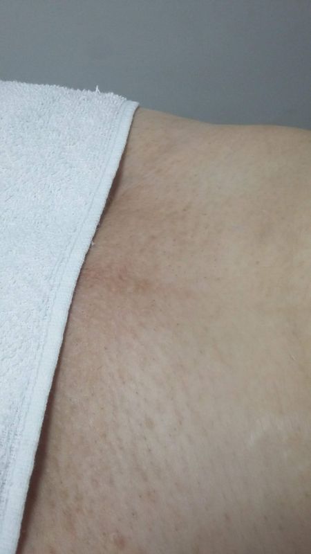 jb beleza pura - beleza e estetica - depilaçao intima