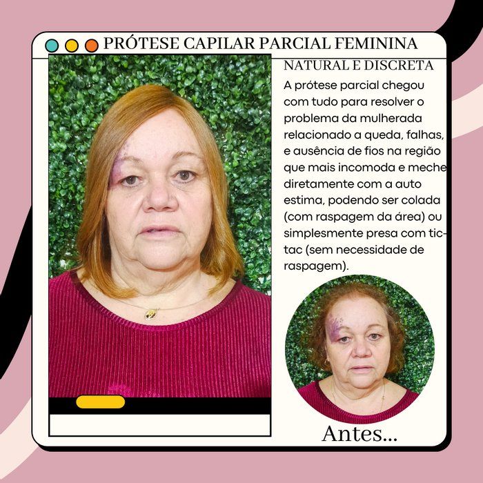 Cabelo dos Sonhos DF - Beleza & Estética - Prótese capilar feminina