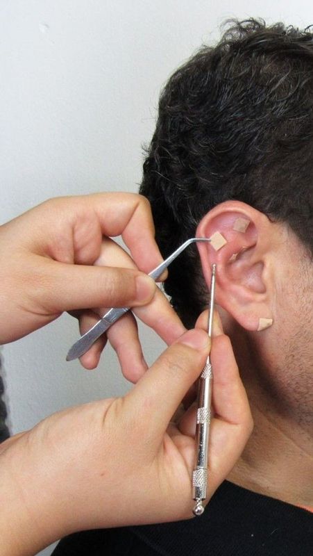 Enfª Priscila Biggi  - Estética e saúde  - Acupuntura auricular 