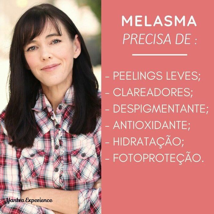 Enfª Priscila Biggi  - Estética e saúde  - Tratamento para melasma