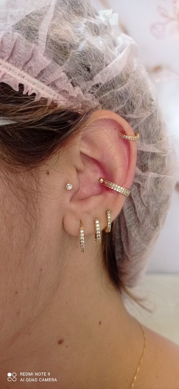 Rosângela Mendes - saúde e estética - Harmonização auricular