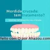 Sim, e o tratamento deve ser feito o mais rápido possível, visto que a mordida cruzada pode causar problemas complicados se não for corrigida. O tratamento é feito com aparelhos fixos ou móveis. O tipo de aparelho depende muito de cada situação.  #dicas #cuidados #mordidacruzada #AhazouSaude #odonto #dentes