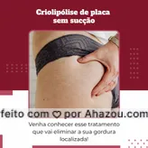 Entre em contato e conheça esse tratamento nada invasivo e indolor que vai eliminar a sua gordura localizada!
Agende uma avaliação!
#AhazouBeauty #beleza  #estetica  #esteticaavancada  #esteticaavançada  #esteticacorporal  #esteticaecosmetica  #esteticista  #saúde 