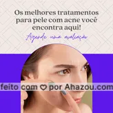Conheça nossos diversos tratamentos para pele com acne.
Entre em contato e agende uma avaliação!
#AhazouBeauty #beleza  #bemestar  #esteticafacial  #limpezadepele  #peeling  #saúde  #skincare 
