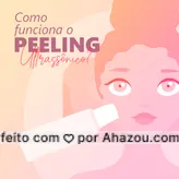 O Peeling Ultrassônico é um procedimento que usa o calor ♨️ das ondas do ultrassom para remover células mortas e estimular a produção de colágeno.

Não é necessário nenhum pré-cuidado antes da realização do tratamento, mas após é recomendado evitar a exposição ☀️ solar, utilizar protetor solar frequentemente e manter as áreas hidratadas ?. Por não ser um procedimento invasivo, não é necessário ficar em repouso, podendo retornar a sua rotina de imediato ?.

O procedimento não ? é recomendado para pessoas que possuam marca-passo, próteses metálicas ou sejam gestantes.

#pele #peelingultrassônico #AhazouBeauty #estéticafacial #saúde #bemestar #peeling