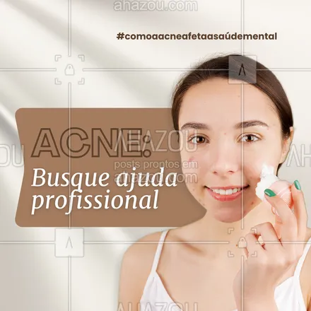 posts, legendas e frases de posts para todos para whatsapp, instagram e facebook: A acne tem tratamento!  Consulte um dermatologista e um profissional de saúde mental para encontrar as melhores soluções para você. ✨ Lembre-se: você merece se sentir bem na sua própria pele. 
#acne #saudemental #autoestima #beleza #ahazou #tendência 