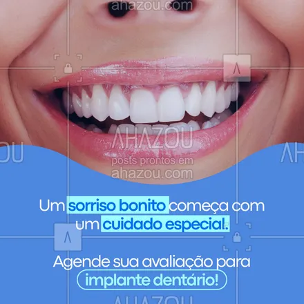 posts, legendas e frases de  para whatsapp, instagram e facebook: Recupere a confiança e o prazer de sorrir! ✨
O implante dentário devolve a funcionalidade e a estética do seu sorriso com conforto e segurança.
💬 Agende sua avaliação e descubra como transformar seu sorriso hoje mesmo!
#implantedentario #odontologia #sorriso #dentista #saudebucal #autoestima #odontologiaintegrada #reabilitacaoral #sorrisoperfeito #cuidadoscomsorriso