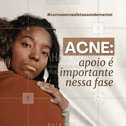 posts, legendas e frases de posts para todos para whatsapp, instagram e facebook: Você não está sozinho(a) nessa jornada. ❤️ Ter o apoio de amigos, familiares e profissionais de saúde é fundamental para lidar com os desafios da acne e cuidar da sua saúde mental.
#acne #saudemental #autoestima #beleza #ahazou #tendência 