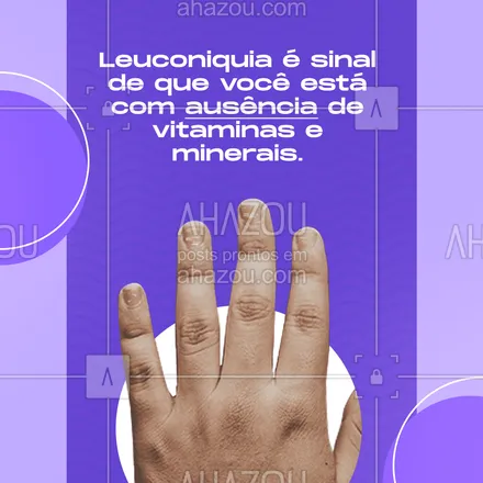 posts, legendas e frases de podologia para whatsapp, instagram e facebook: Manchas brancas ou leuconiquia é o indicativo que você está precisa de algumas vitaminas e minerais específicos. Entre em contato para saber mais ou agendar seu horário. #unhabranca #leuconiquia #AhazouSaude #convite #tratamento #podologia